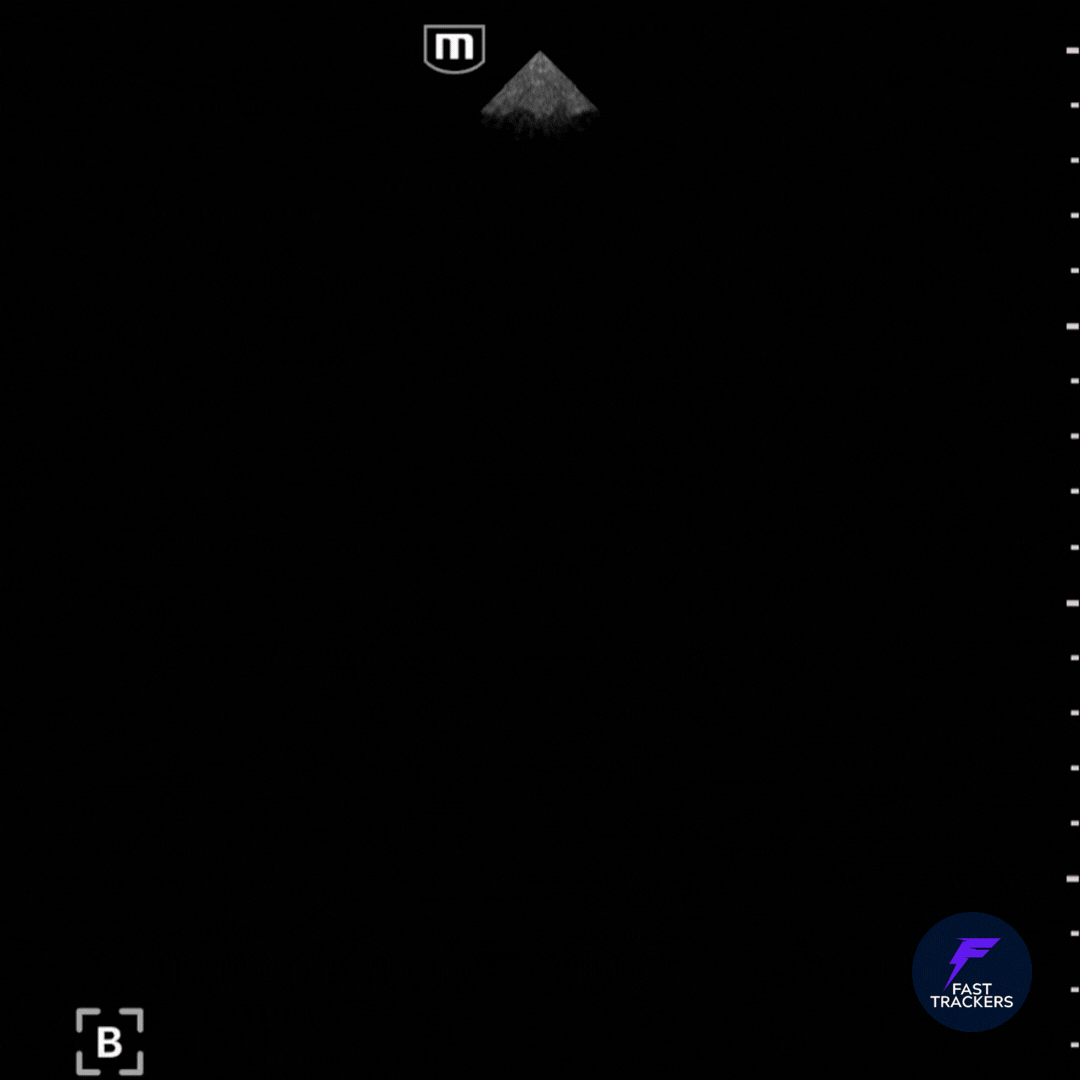 GIF animation