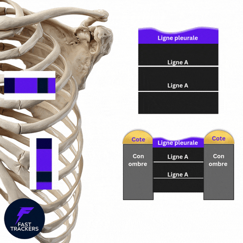 Comparaison échographie pulmonaire : coupe longitudinale avec ombres des côtes et coupe transversale dans l'espace intercostal montrant les lignes A.